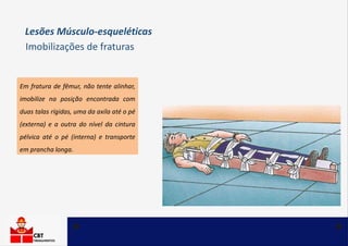 Em fratura de fêmur, não tente alinhar,
imobilize na posição encontrada com
duas talas rígidas, uma da axila até o pé
(externa) e a outra do nível da cintura
pélvica até o pé (interna) e transporte
em prancha longa.
Imobilizações de fraturas
Lesões Músculo-esqueléticas
 