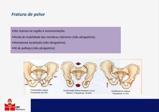•Dor intensa na região à movimentação;
•Perda de mobilidade dos membros inferiores (não obrigatório);
•Hematoma localizado (não obrigatório);
•Pé de palhaço (não obrigatório).
Fratura de pelve
 
