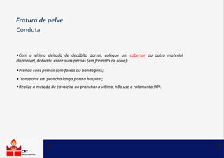 •Com a vítima deitada de decúbito dorsal, coloque um cobertor ou outro material
disponível, dobrado entre suas pernas (em formato de cone);
•Prenda suas pernas com faixas ou bandagens;
•Transporte em prancha longa para o hospital;
•Realize o método de cavaleira ao pranchar a vítima, não use o rolamento 90º.
Fratura de pelve
Conduta
 