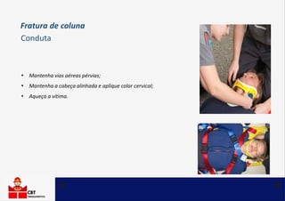 • Mantenha vias aéreas pérvias;
• Mantenha a cabeça alinhada e aplique colar cervical;
• Aqueça a vítima.
Fratura de coluna
Conduta
 