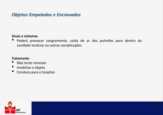 Sinais e sintomas
• Poderá provocar sangramento, saída de ar dos pulmões para dentro da
cavidade torácica ou outras complicações
Tratamento
• Não tente remover
• Imobilize o objeto
• Conduza para o hospital.
Objetos Empalados e Encravados
 