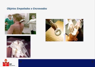 Objetos Empalados e Encravados
 