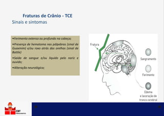 •Ferimento extenso ou profundo na cabeça;
•Presença de hematoma nas pálpebras (sinal de
Guaxinim) e/ou roxo atrás das orelhas (sinal de
Battle)
•Saída de sangue e/ou líquido pelo nariz e
ouvido;
•Alteração neurológica;
Fraturas de Crânio - TCE
Sinais e sintomas
 