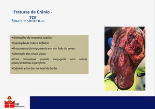 •Alterações da resposta pupilar;
•Exposição de massa cefálica
•Fraqueza ou formigamento em um lado do corpo
•Alteração dos sinais vitais
•Crise convulsiva quando conjugada com outros
sinais/sintomas específicos
•Cefaleia e/ou dor no local da lesão
Fraturas de Crânio -
TCE
Sinais e sintomas
 