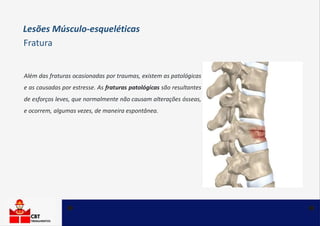 Lesões Músculo-esqueléticas
Fratura
Além das fraturas ocasionadas por traumas, existem as patológicas
e as causadas por estresse. As fraturas patológicas são resultantes
de esforços leves, que normalmente não causam alterações ósseas,
e ocorrem, algumas vezes, de maneira espontânea.
 