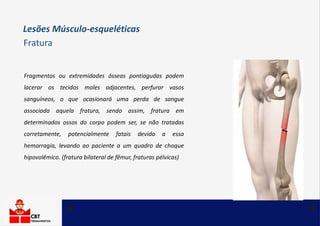 Fragmentos ou extremidades ósseas pontiagudas podem
lacerar os tecidos moles adjacentes, perfurar vasos
sanguíneos, o que ocasionará uma perda de sangue
associada aquela fratura, sendo assim, fratura em
determinados ossos do corpo podem ser, se não tratadas
corretamente, potencialmente fatais devido a essa
hemorragia, levando ao paciente a um quadro de choque
hipovolêmico. (fratura bilateral de fêmur, fraturas pélvicas)
Lesões Músculo-esqueléticas
Fratura
 