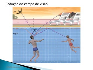 Redução do campo de visão 
2 Reflexão total 
 