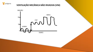 VENTILAÇÃO MECÂNICA NÃO INVASIVA (VNI)
 