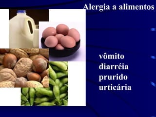 Alergia a alimentos
vômito
diarréia
prurido
urticária
 