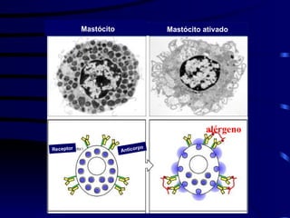 Mastócito ativado
Receptor
Anticorpo
Mastócito
alérgeno
 