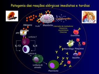 Patogenia das reações alérgicas imediatas e tardias
Liberação de mediadores
Histamina
Leucotrienos
Citocinas
FcRI
Y
Y
Y
Y
Y
Y
Mastócito
Linfócito T
Linfócito B
IL-4
IL-13
Linfócito B
ativado
Y
Y
Y
Y
Y
Y
Y
Y
Y
Y
Y
Plasmócito
Macrófago
Y
Eosinófilo
Y
Plaquetas
Y
Basófilo
Alérgeno
APC
 