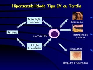 Hipersensibilidade Tipo IV ou Tardia
Antígeno
Estimulação
contínua
Solução
Intradémica
Linfócito Th
Granuloma
Dermatite de
contato
Diagnóstico
Resposta à tuberculina
 