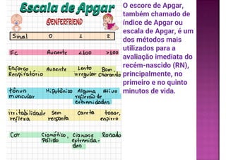 O escore de Apgar,
também chamado de
índice de Apgar ou
escala de Apgar, é um
dos métodos mais
utilizados para a
avaliação imediata do
recém-nascido (RN),
principalmente, no
primeiro e no quinto
minutos de vida.
.
 