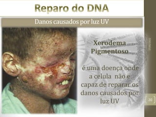 17/05/2022
20
Excisão de Nucleotideos
Danoscausadosporluz UV
Xerodema
Pigmentoso
é uma doença onde
a celula não e
capaz de reparar os
danos causados por
luz UV
 