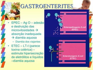 GASTROENTERITES

• EPEC – Ag O – adesão
  e destruição das
  microvilosidades 
  absorção inadequada
   diarréia aquosa
   – Diarréia dos viajantes
• ETEC – LT-I (parece
  toxina colérica) –
  estimula hipersecreção
  de eletrólitos e líquidos
  –diarréia aquosa
 