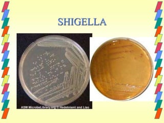 SHIGELLA
 