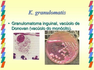 K. granulomatis
• Granulomatoma inguinal, vacúolo de
  Donovan (vacúolo do monócito).
 