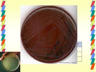 PROTEUS




Enterobactérias   PYR   Fenilalanina

Salmonella        Neg   Neg

Citrobacter       Pos   Neg

Proteus           Neg   Pos
 