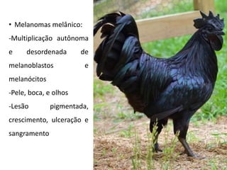 • Melanomas melânico:
-Multiplicação autônoma
e desordenada de
melanoblastos e
melanócitos
-Pele, boca, e olhos
-Lesão pigmentada,
crescimento, ulceração e
sangramento
 