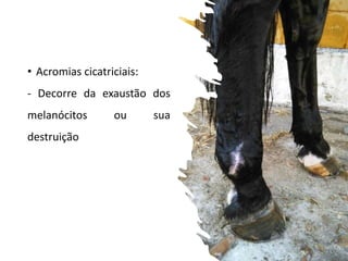 • Acromias cicatriciais:
- Decorre da exaustão dos
melanócitos ou sua
destruição
 