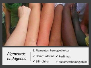 Pigmentos
endógenos
3. Pigmentos hemoglobínicos
 Hemossiderina
 Bilirrubina
 Porfirinas
 Sulfametahemoglobina
 