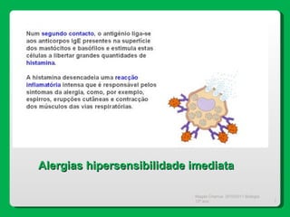 Magda Charrua  2010/2011 Biologia 12º ano  Alergias hipersensibilidade imediata 