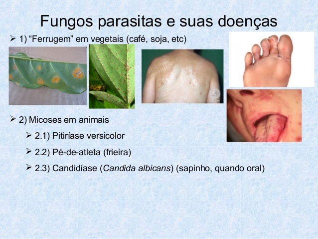 Outeirinhos em pregos de mãos da razão e tratamento