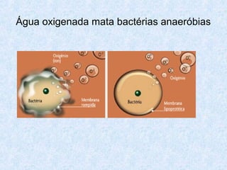 Água oxigenada mata bactérias anaeróbias
 