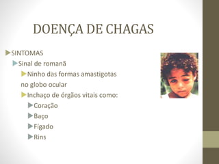 DOENÇA DE CHAGAS
SINTOMAS
Sinal de romanã
Ninho das formas amastigotas
no globo ocular
Inchaço de órgãos vitais como:
Coração
Baço
Fígado
Rins
 