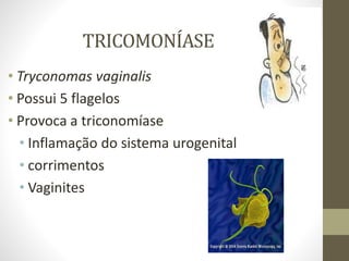 TRICOMONÍASE
• Tryconomas vaginalis
• Possui 5 flagelos
• Provoca a triconomíase
• Inflamação do sistema urogenital
• corrimentos
• Vaginites
 