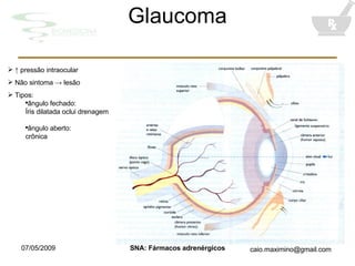 Glaucoma ↑  pressão intraocular Não sintoma -> lesão Tipos: ângulo fechado: Íris dilatada oclui drenagem ângulo aberto: crônica 