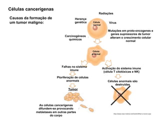 Vírus
Carcinogéneos
químicos
Radiações
Herança
genética
Mutações em proto-oncogenes e
genes supressores de tumor
alteram o crescimento celular
normal
Célula
normal
Célula
anormal
Falhas no sistema
imune
Ploriferação de células
anormais
Tumor
Activação do sistema imune
(célula T citotóxicas e NK)
Células anormais são
destruídas
As células cancerígenas
difundem-se provocando
metástases em outras partes
do corpo
Causas da formação de
um tumor maligno:
Células cancerígenas
h"p://www.news‐medical.net/health/What‐is‐Cancer.aspx
 