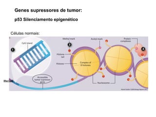 ilha CpG
Células normais:
Manel Esteller F1000 Biology Reports 2011
p53 Silenciamento epigenético
Genes supressores de tumor:
 
