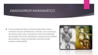 KWASHIORKOR MARASMÁTICO
 É uma junção das duas, é caracterizado pelos sinais e
sintomas clássicos do Marasmo, contudo, com a presença
de edemas pelo corpo. Essa forma mista é marcada pela
desnutrição não só de carboidratos e gordura mas também
das proteínas, sendo considerada uma desnutrição
proteico-calórica(DPC).
 