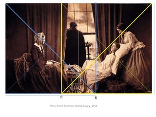 Henry Peach Robinson, Fading Away, 1858
fi fi
 