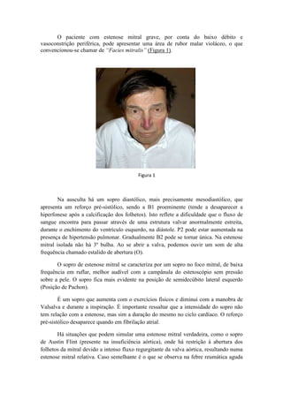O paciente com estenose mitral grave, por conta do baixo débito e
vasoconstrição periférica, pode apresentar uma área de rubor malar violáceo, o que
convencionou-se chamar de “Facies mitralis” (Figura 1).
Na ausculta há um sopro diastólico, mais precisamente mesodiastólico, que
apresenta um reforço pré-sistólico, sendo a B1 proeminente (tende a desaparecer a
hiperfonese após a calcificação dos folhetos). Isto reflete a dificuldade que o fluxo de
sangue encontra para passar através de uma estrutura valvar anormalmente estreita,
durante o enchimento do ventrículo esquerdo, na diástole. P2 pode estar aumentada na
presença de hipertensão pulmonar. Gradualmente B2 pode se tornar única. Na estenose
mitral isolada não há 3º bulha. Ao se abrir a valva, podemos ouvir um som de alta
frequência chamado estalido de abertura (O).
O sopro de estenose mitral se caracteriza por um sopro no foco mitral, de baixa
frequência em ruflar, melhor audível com a campânula do estetoscópio sem pressão
sobre a pele. O sopro fica mais evidente na posição de semidecúbito lateral esquerdo
(Posição de Pachon).
É um sopro que aumenta com o exercícios físicos e diminui com a manobra de
Valsalva e durante a inspiração. É importante ressaltar que a intensidade do sopro não
tem relação com a estenose, mas sim a duração do mesmo no ciclo cardíaco. O reforço
pré-sistólico desaparece quando em fibrilação atrial.
Há situações que podem simular uma estenose mitral verdadeira, como o sopro
de Austin Flint (presente na insuficiência aórtica), onde há restrição à abertura dos
folhetos da mitral devido a intenso fluxo regurgitante da valva aórtica, resultando numa
estenose mitral relativa. Caso semelhante é o que se observa na febre reumática aguda
Figura 1
 