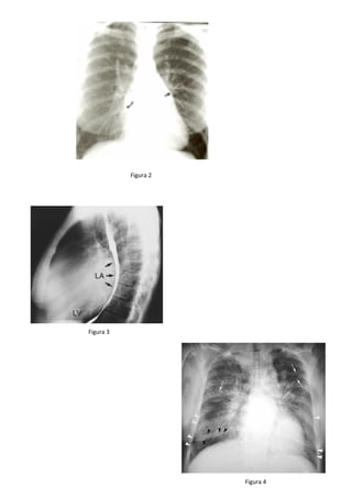 Figura 2
Figura 3
Figura 4
 