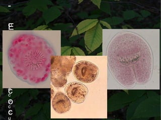 -
E
c
h
i
n
o
c
o
c
O
v
o
s
d
e
E
c
h
i
n
o
c
o
c
c
u
 