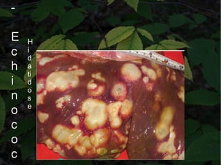 -
E
c
h
i
n
o
c
o
c
H
i
d
a
ti
d
o
s
e
 