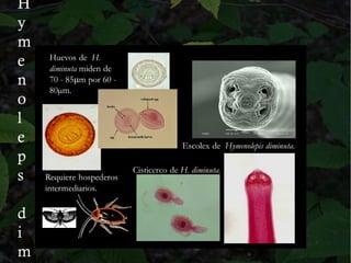 H
y
m
e
n
o
l
e
p
s
d
i
m
 