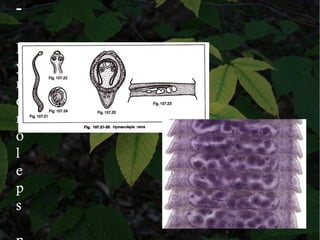 -
H
y
m
e
n
o
l
e
p
s
 