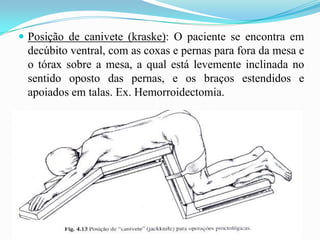  Posição de canivete (kraske): O paciente se encontra em
decúbito ventral, com as coxas e pernas para fora da mesa e
o tórax sobre a mesa, a qual está levemente inclinada no
sentido oposto das pernas, e os braços estendidos e
apoiados em talas. Ex. Hemorroidectomia.
 