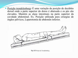 Posição trendelenburg: É uma variação da posição de decúbito
dorsal onde a parte superior do dorso é abaixada e os pés são
elevados. Mantém as alças intestinais na parte superior da
cavidade abdominal. Ex. Posição utilizada para cirurgias de
órgãos pélvicos, Laparotomia de abdomên inferior.
 