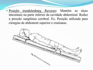  Posição trendelenburg Reverso: Mantém as alças
intestinais na parte inferior da cavidade abdominal. Reduz
a pressão sangüínea cerebral. Ex. Posição utilizada para
cirurgias de abdomem superior e cranianas.
 