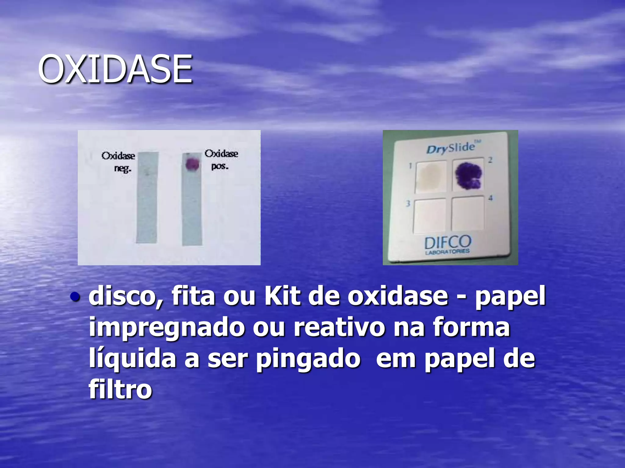 OXIDASEdisco, fita ou Kit de oxidase - papel impregnado ou reativo na forma líquida a ser pingado  em papel de filtroMOTILIDADEPODE SER FEITA EM BHI OU TSB. COLOCAR UMA ALÇA DE BACTÉRIAS NO CALDO E DEIXAR EM REPOUSO DE 4 A 24 HORAS A T AMBIENTE.Observar movimento em aumento 40 com condensador baixo e pouca luz.