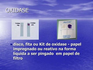 OXIDASEdisco, fita ou Kit de oxidase - papel impregnado ou reativo na forma líquida a ser pingado  em papel de filtroMOTILIDADEPODE SER FEITA EM BHI OU TSB. COLOCAR UMA ALÇA DE BACTÉRIAS NO CALDO E DEIXAR EM REPOUSO DE 4 A 24 HORAS A T AMBIENTE.Observar movimento em aumento 40 com condensador baixo e pouca luz.