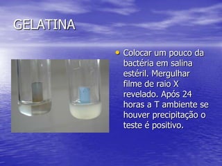 Sistema de Kits prontos, semi-automatizados e automatizadosAuto-Scan –4 –microscanWalkAwayVitekBBLBactreyKits para não fermentadoresOutros