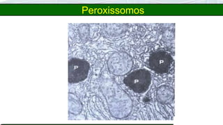 Peroxissomos
 