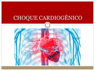 CHOQUE CARDIOGÊNICO
 