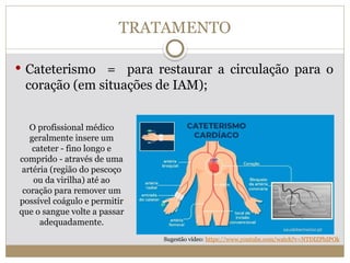 TRATAMENTO
 Cateterismo = para restaurar a circulação para o
coração (em situações de IAM);
O profissional médico
geralmente insere um
cateter - fino longo e
comprido - através de uma
artéria (região do pescoço
ou da virilha) até ao
coração para remover um
possível coágulo e permitir
que o sangue volte a passar
adequadamente.
Sugestão vídeo: https://www.youtube.com/watch?v=NTDIZPbIPOk
 